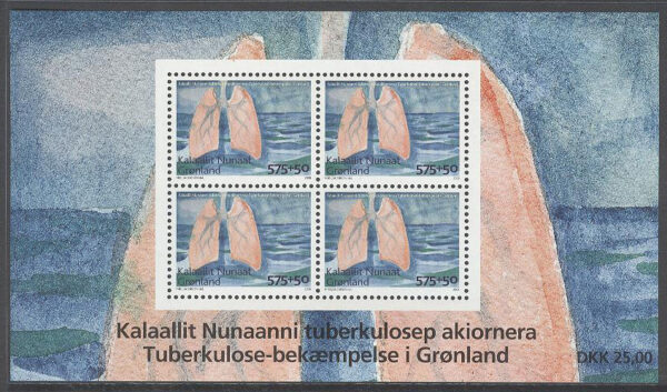 Grönland - F BL  55 Kampen mot tuberkulos, block **